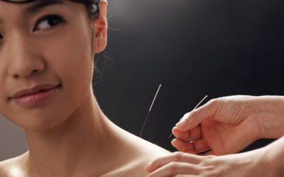 Dry Needling Benefits