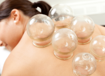 Cupping Therapy- More than just a Fad