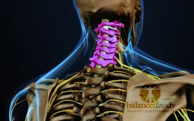 Neck Pain