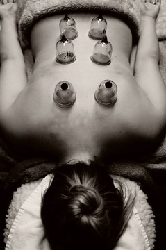 cupping therapy services